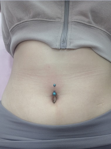 Navel Anatomy