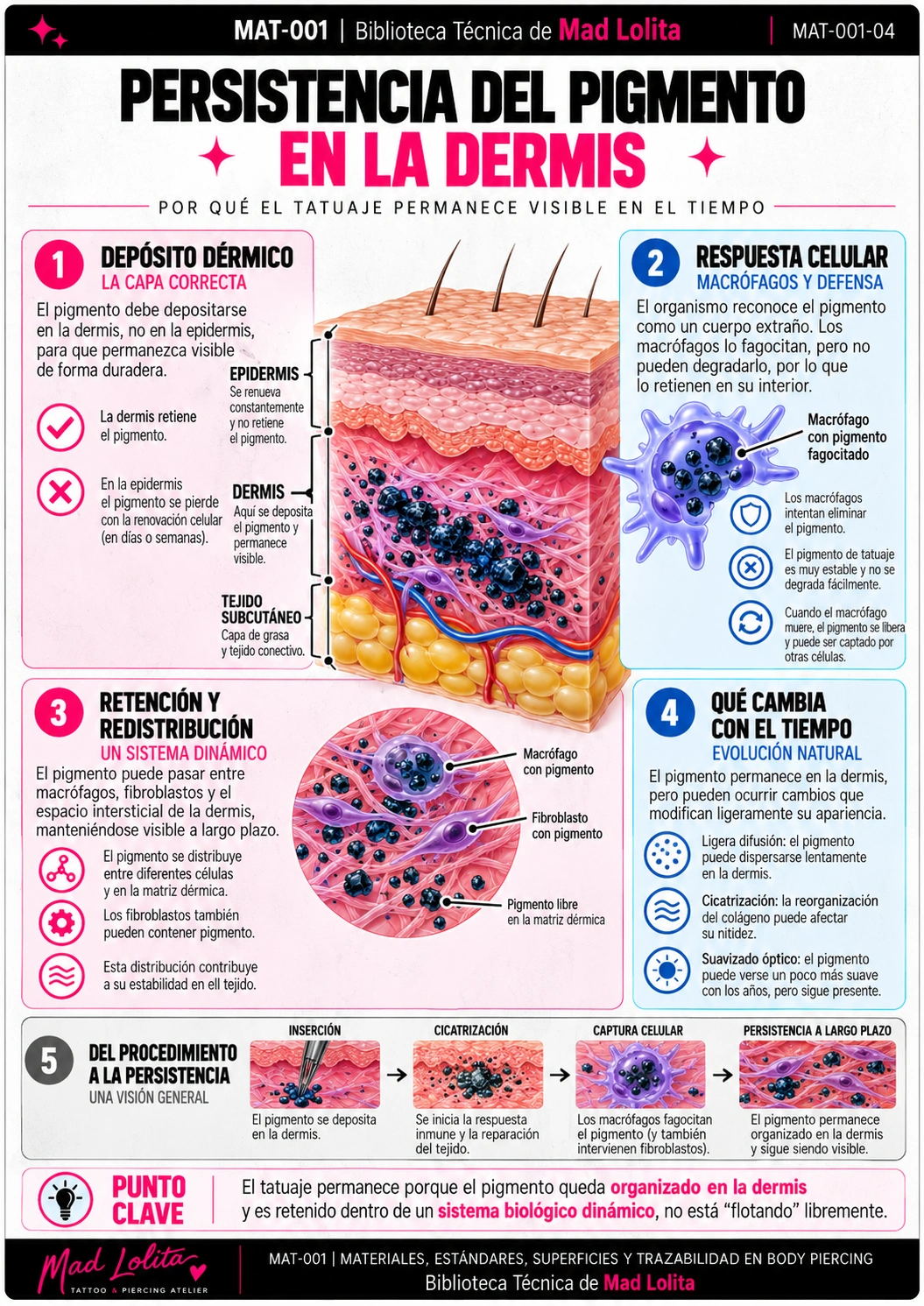 Persistencia del pigmento de tatuaje en la dermis con participación de macrófagos, fibroblastos y redistribución.