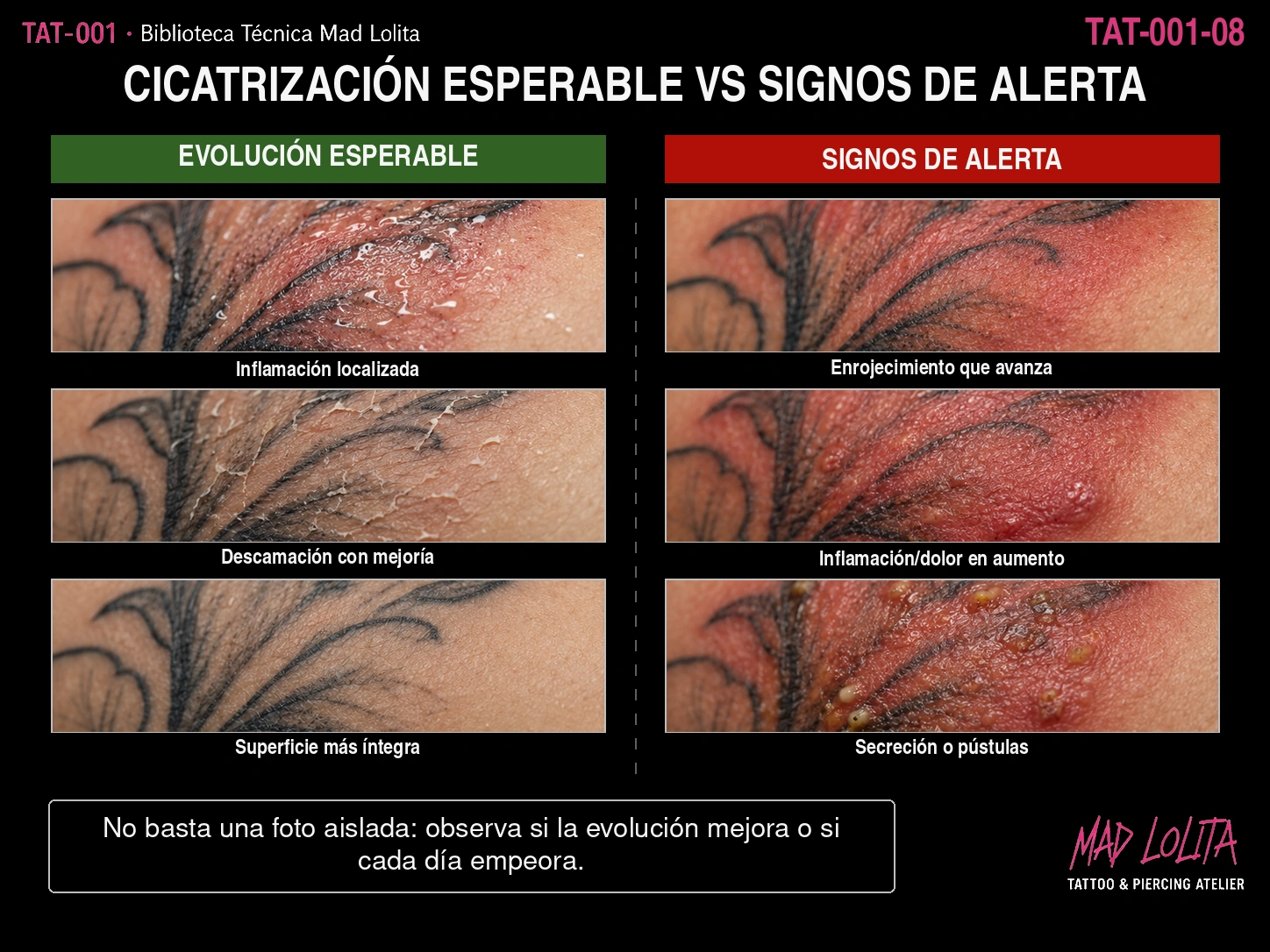 Comparación entre evolución esperable y signos de alerta durante la cicatrización de un tatuaje.