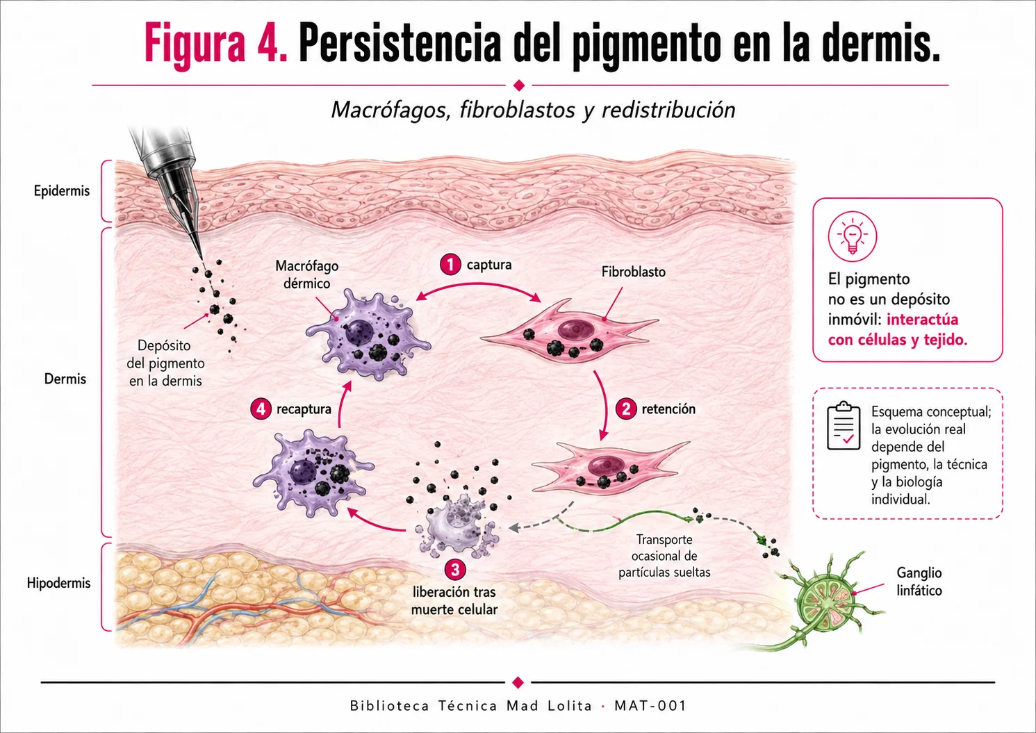 Persistencia del pigmento de tatuaje en la dermis mediante interacción con macrófagos, fibroblastos y tejido.